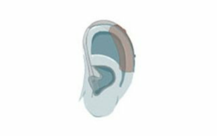 Centro Sordità Ausony - Corigliano Calabro (CS) - protesi acustiche cosenza - apparecchi acustici con convenzione ASP - assistenza tecnica - orecchio e disturbi uditivi